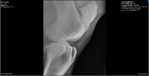 Right Stifle Lateral